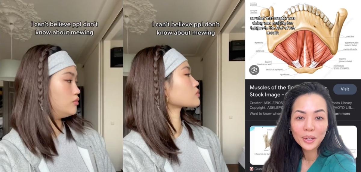 mewing-is-a-controversial-beauty-trend-on-tiktok-details