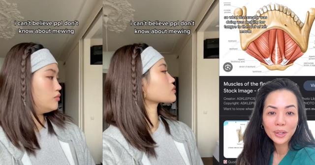 Tiktok creator demonstrates how "mewing" can change her face shape
