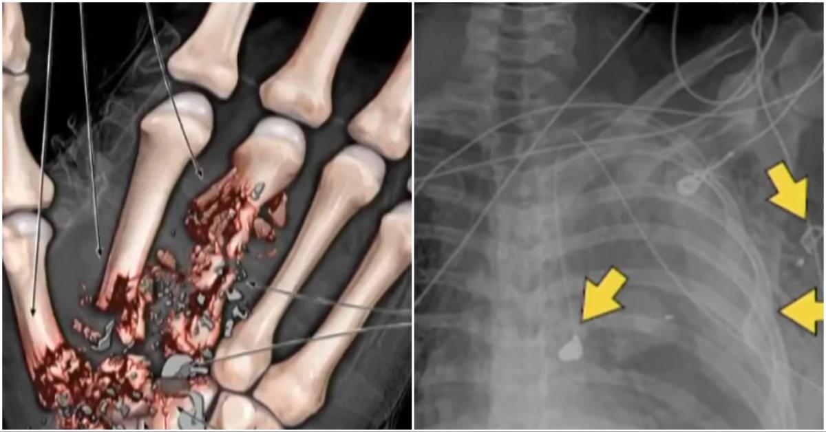 Photos of the bullet damage after the six year old shot his teacher