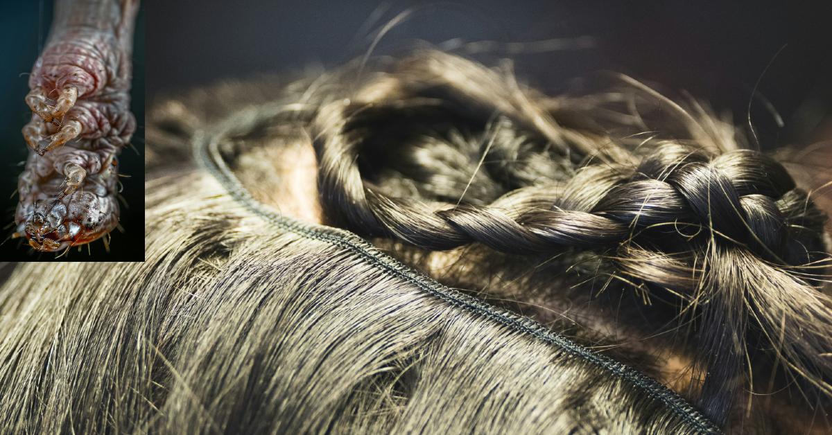 District Tells Parents to Send Kids With Lice to School