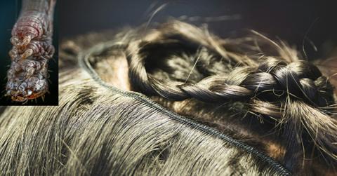 District Tells Parents to Send Kids With Lice to School