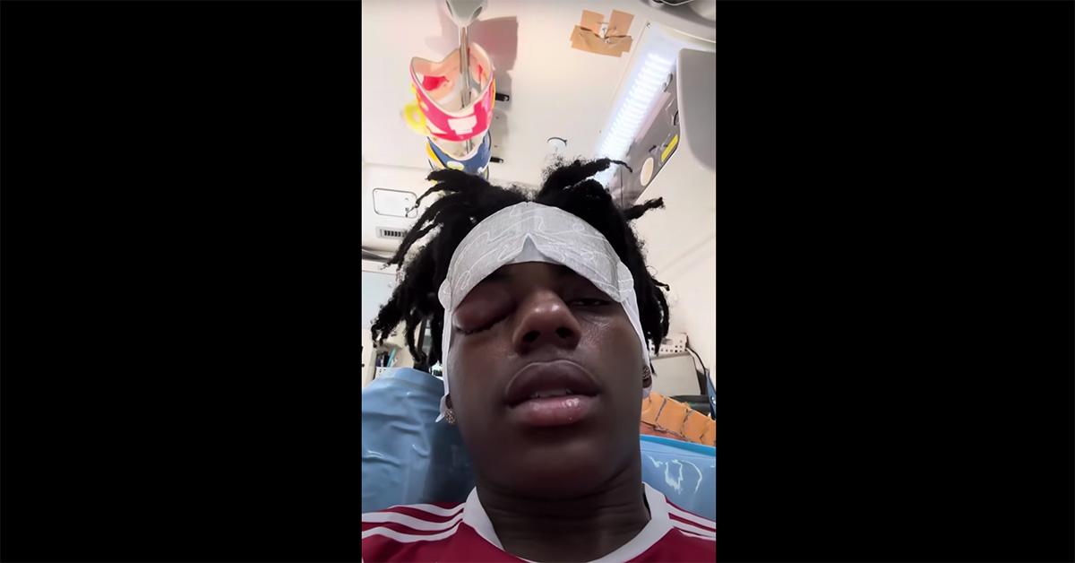 influencer IShowSpeed rushed to emergency surgery