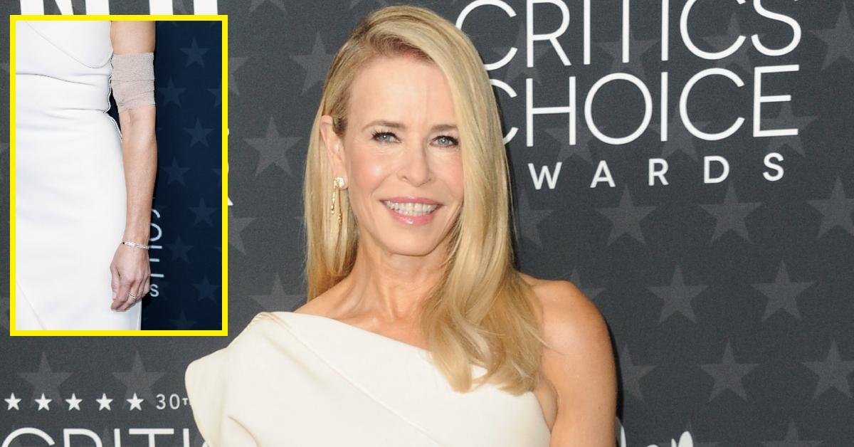 (l-r): Chelsea Handler's PICC line and Chelsea Handler