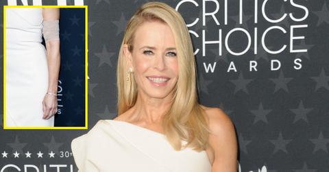 (l-r): Chelsea Handler's PICC line and Chelsea Handler