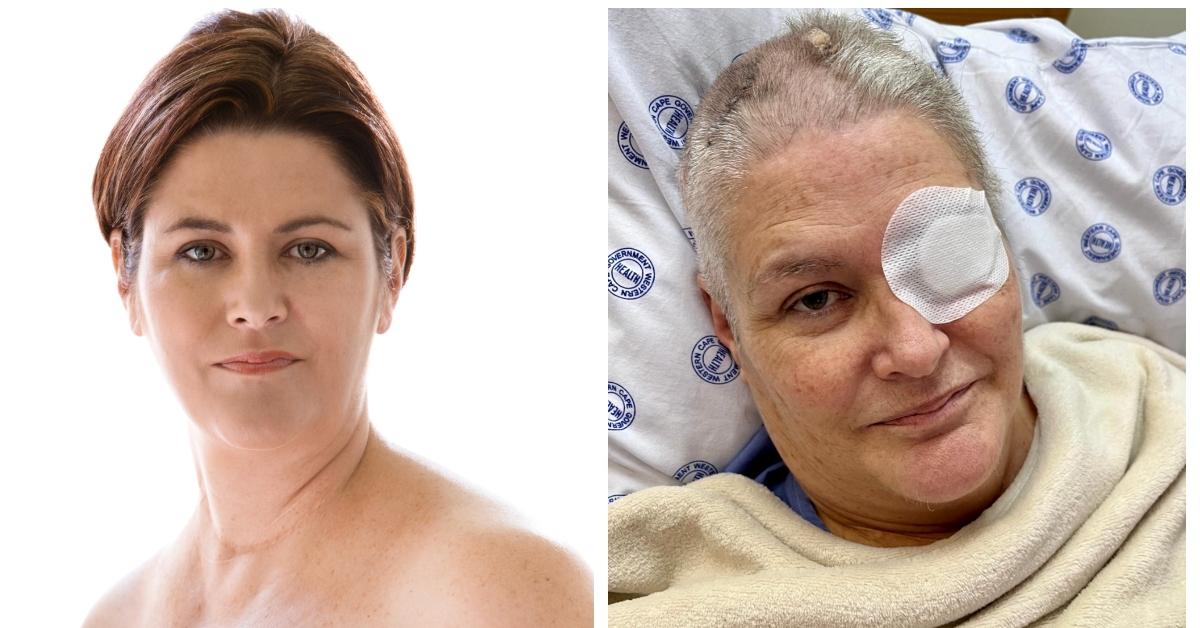 (L-R): Alison Botha years before her aneurysm; Alison Botha in the hospital