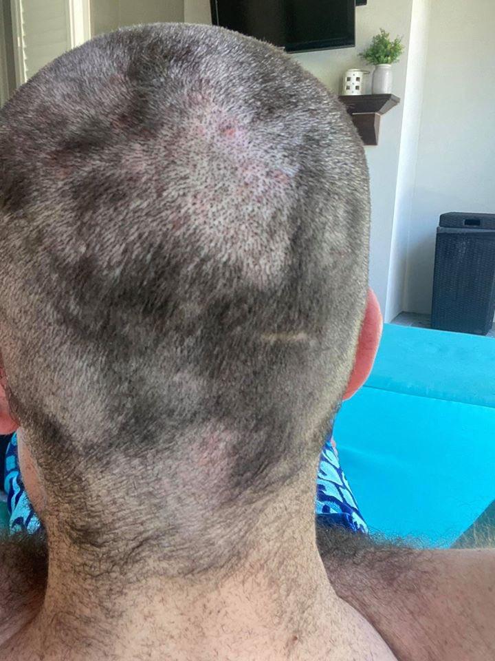 15 Regrettable Quarantine Haircuts People Tried To Give Themselves