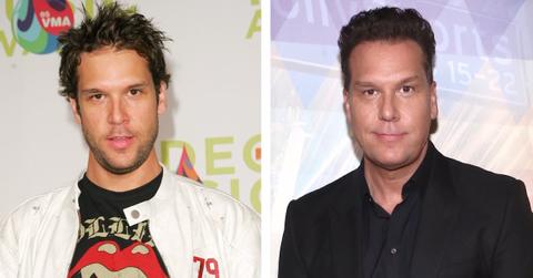 what happened to dane cook face
