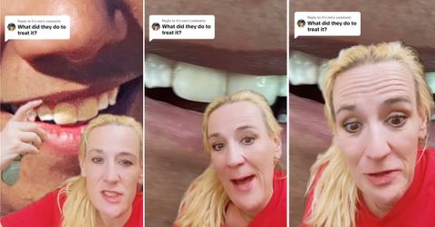 A mom discussing that her son's dental work was cheaper in Portugal