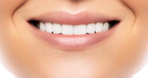 A woman smiling with veneers