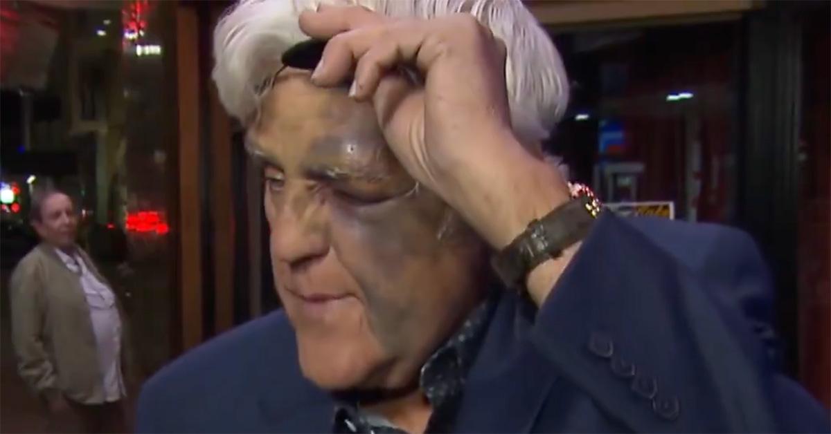 Jay Leno lifting his eyepatch to show his shut eye. 