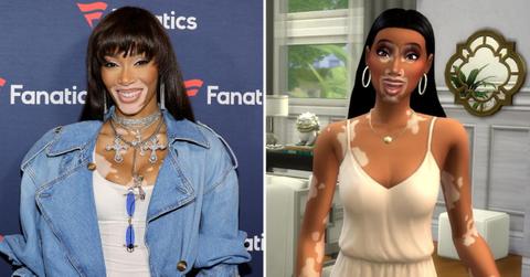 Winnie harlow sims 4 vitiligo