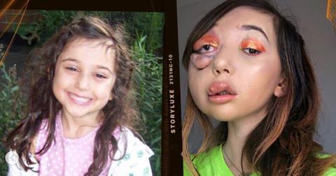 nikki-lilly-medical-condition-1580329537327.jpg