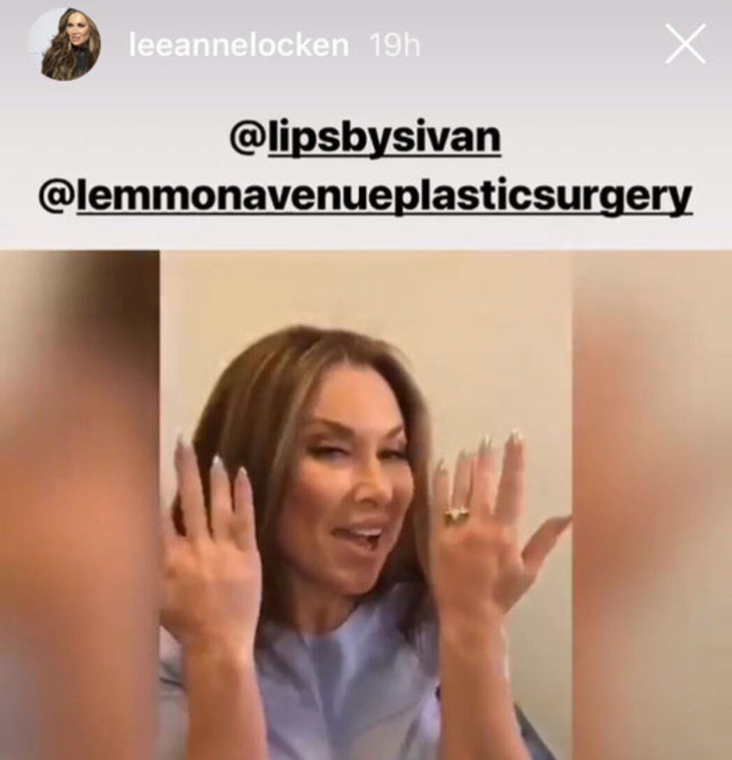 leeanne locken hand fillers