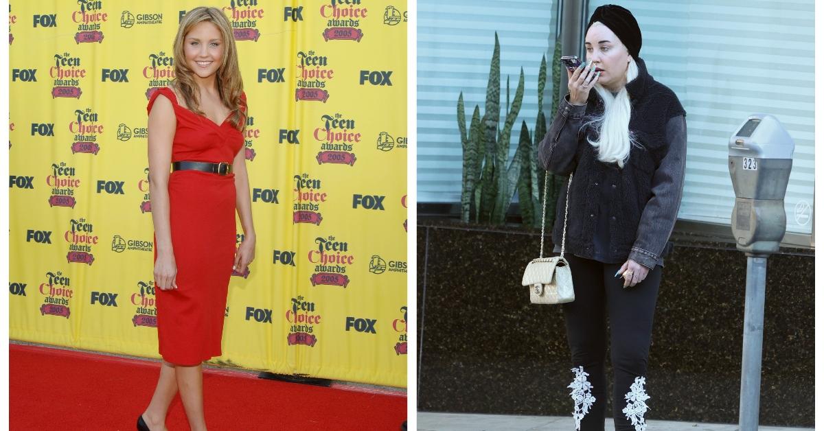 Amanda bynes is doing better now after many ups and downs