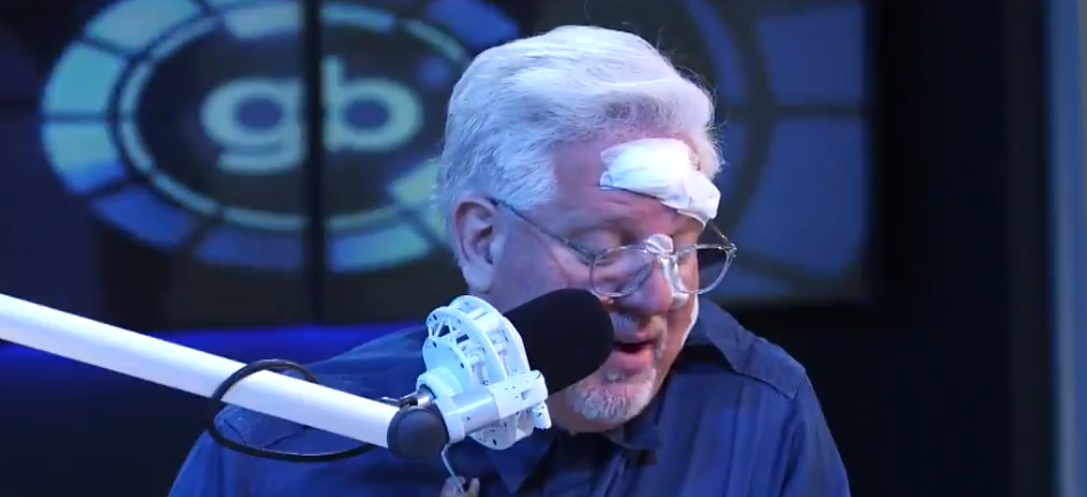 What Happened To Glenn Beck S Face