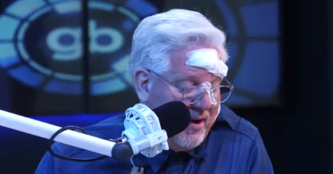 What Happened to Glenn Beck’s Face?