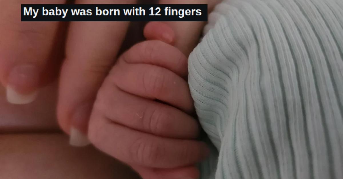 “I Love Her Special Little Pinky Beans” — Mom Shares Photos of Baby Born With 12 Fingers