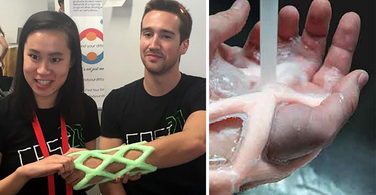 Engineering Students Create Waterproof and Lightweight Arm Cast to Replace Plaster Casts