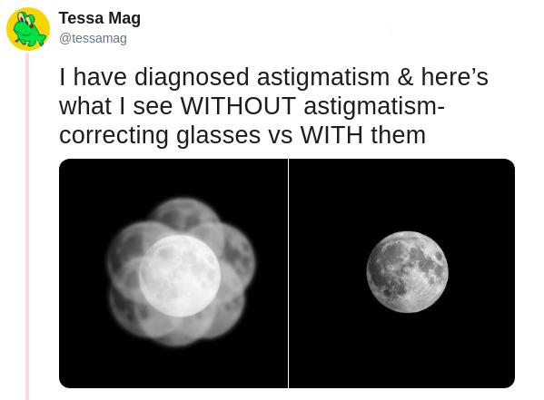 what astigmatism looks like