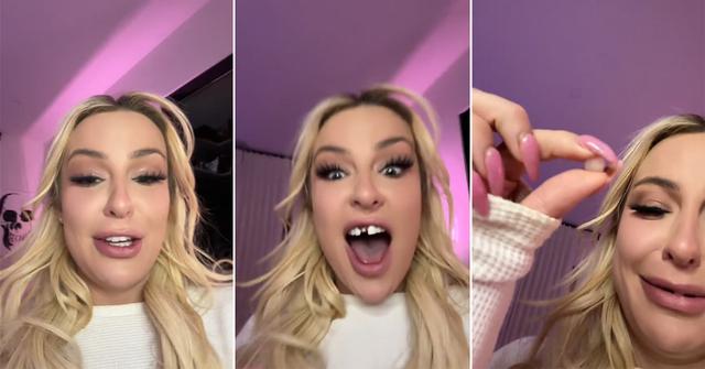 Tana Mongeau's veneers fall out