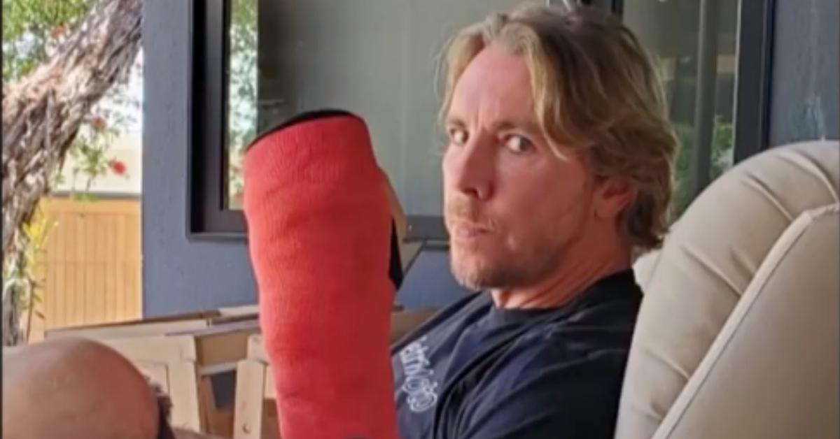 how did dax shepard break his arm