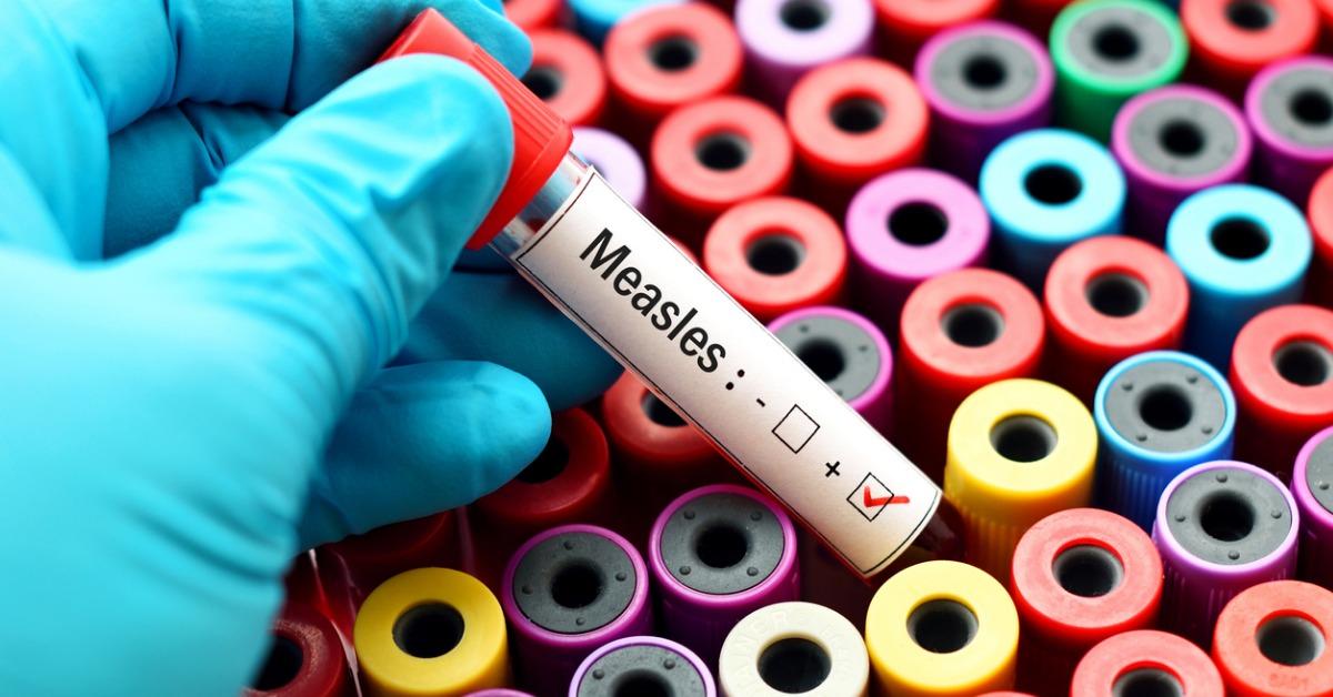 measles-positive-picture-id689072752-1535569639733-1535569641767.jpg