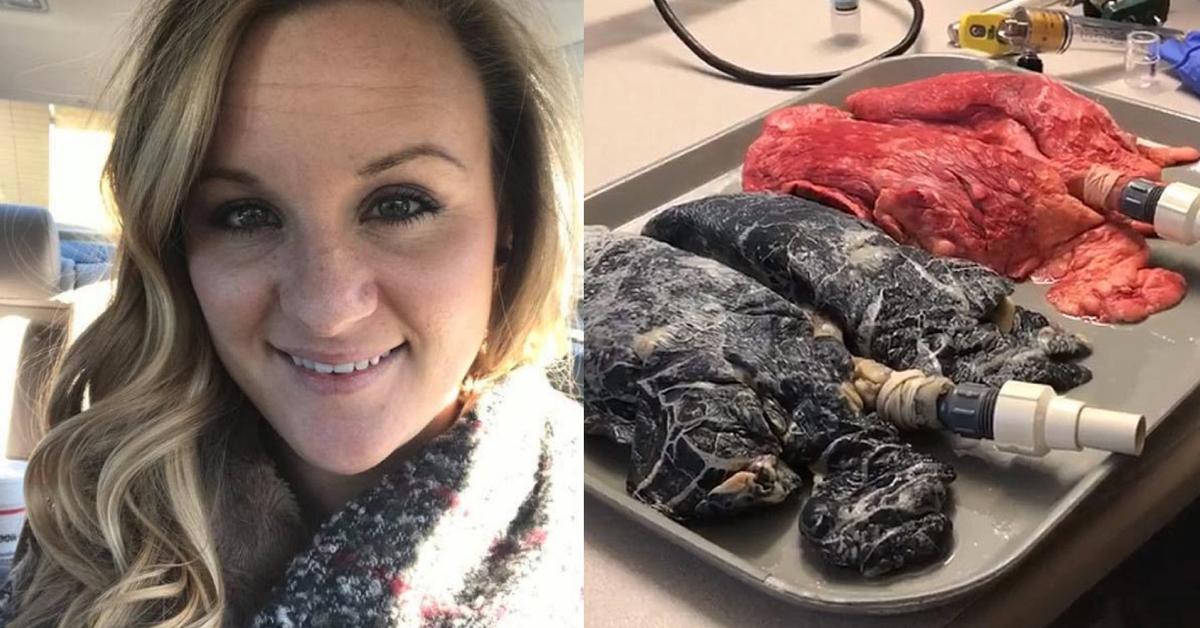 This Video of a Nurse Inflating Cigarette Damaged Lungs Is Horrifying