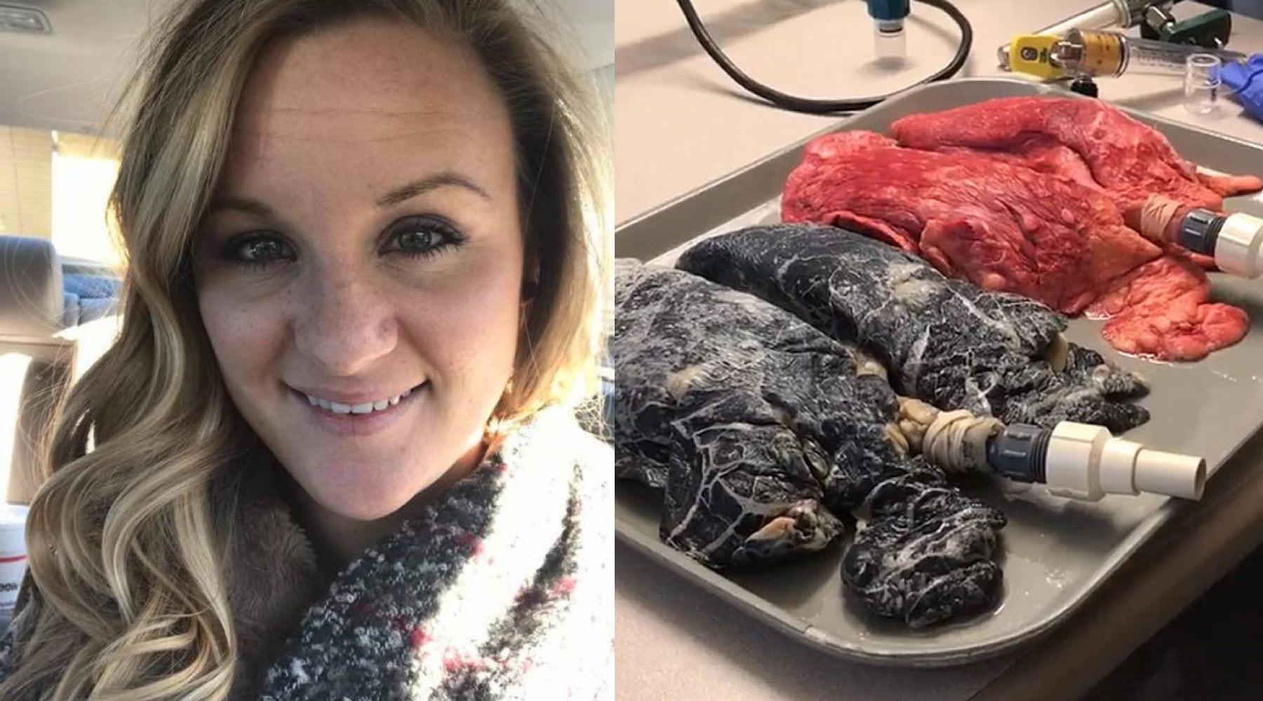 This Video of a Nurse Inflating Cigarette Damaged Lungs Is Horrifying — Watch