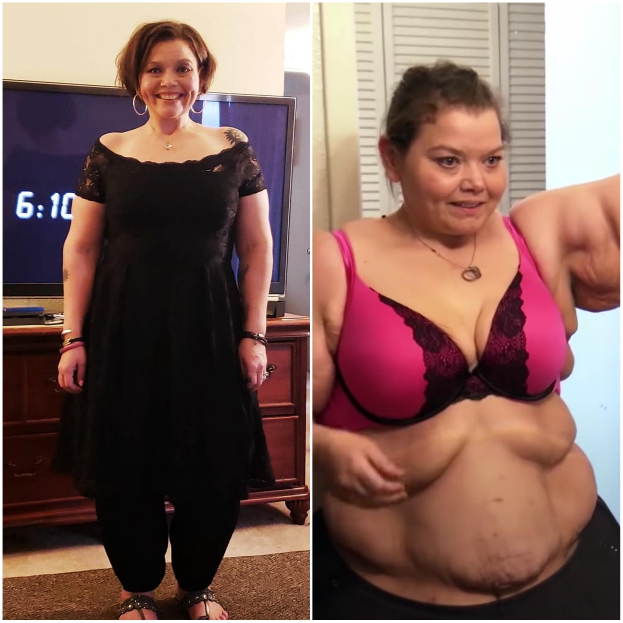 My 600 Lb Life Success Stories Incredible Before And Afters 0107