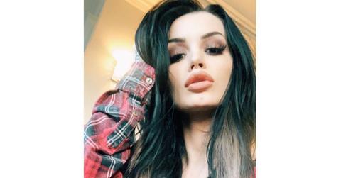 paige wwe plastic surgery