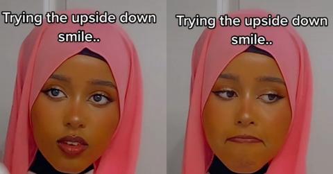 Upside Down Smile Trend