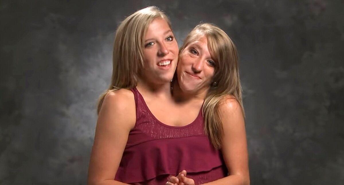 Hensel Twins: Inside the Lives of Abby and Brittany Hensel