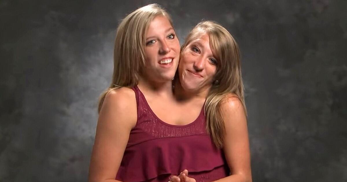 Conjoined Twins Abby And Brittany Married 2024 Perla Brandais