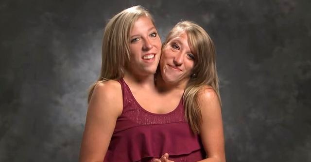 Conjoined twins Abby and Brittany Hensel on their TLC series.