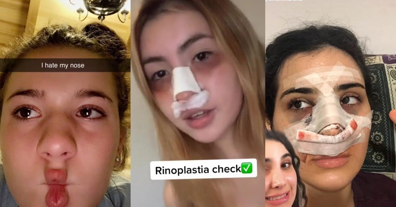 How Do You Get the Nose Job Filter to Work on TikTok?