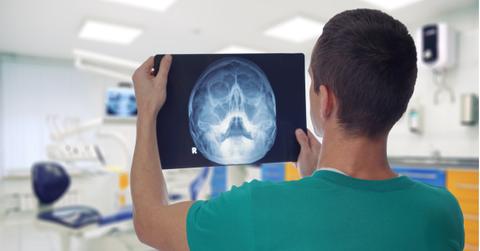 male doctor dentist watching xray of patient picture id