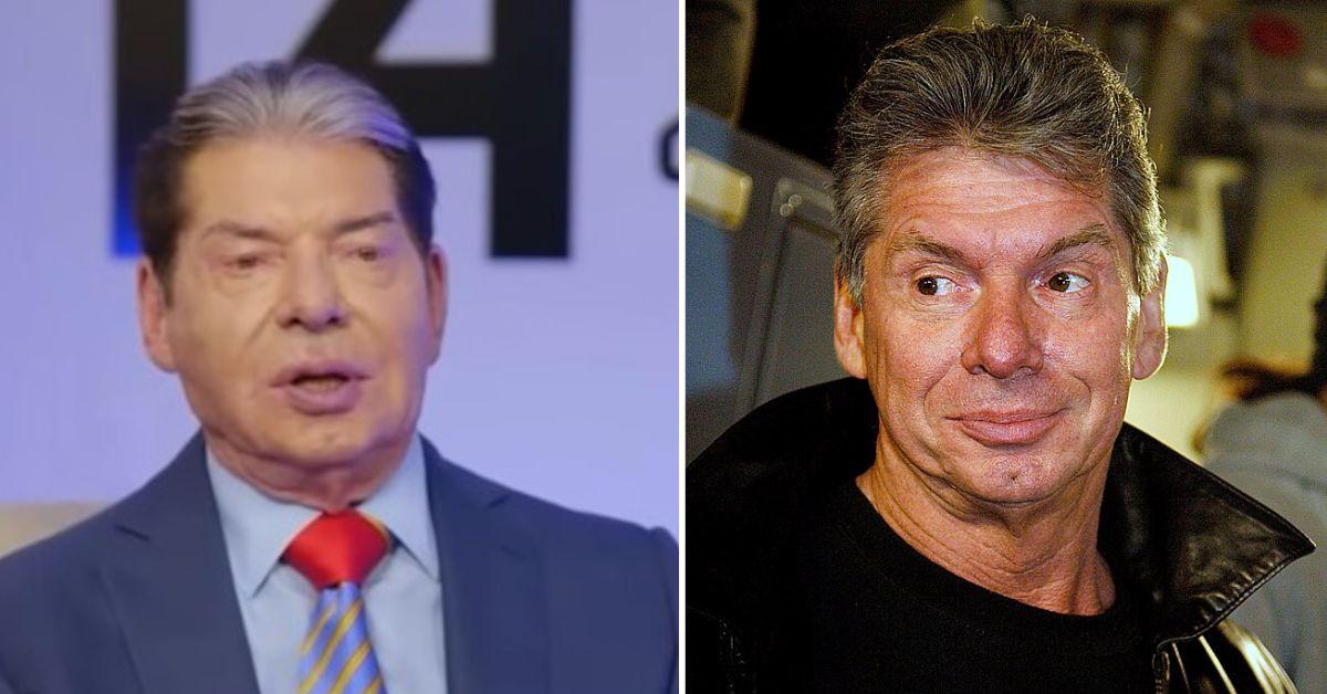 What Happened to Vince McMahon's Face? 