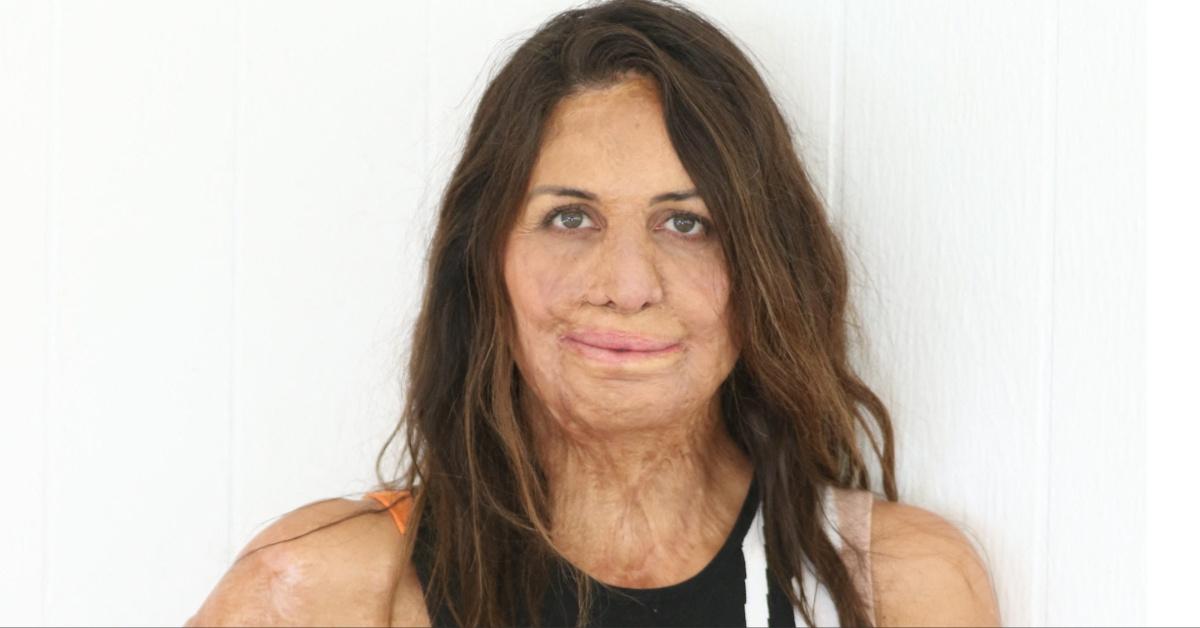 Turia Pitt in 2022 in Sydney, Australia. 
