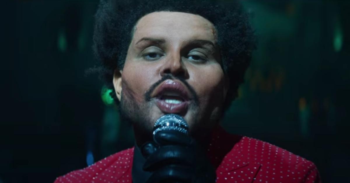 Weeknd Eyes What Happened to The Weeknd's Face? His New Look Explained
