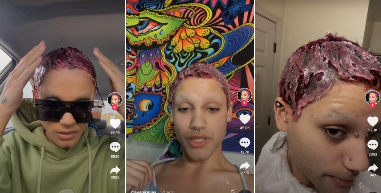 Who Is Avani Reyes? The Tiktok User Is Another Gorilla Glue Victim