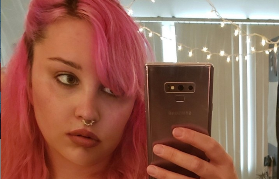 Amanda Bynes shares face tattoo removal progress on Instagram