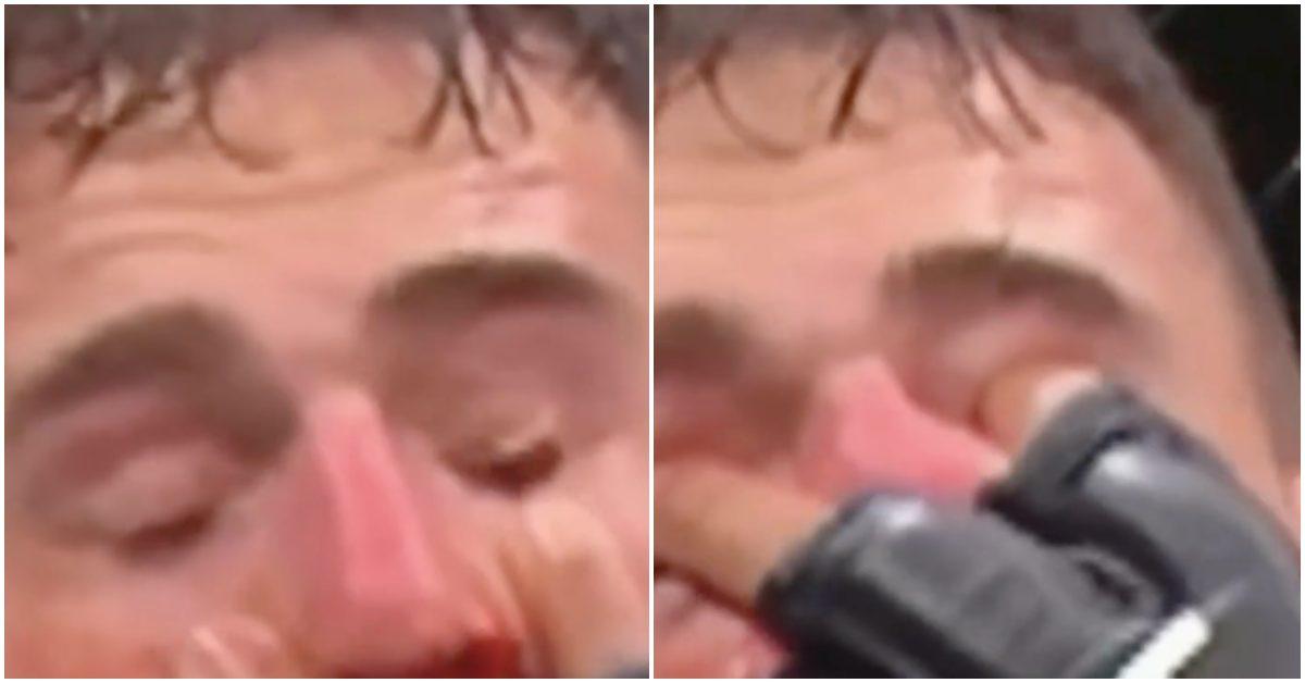 Tom Aspinall getting poked in the eye by Ciryl Gane.