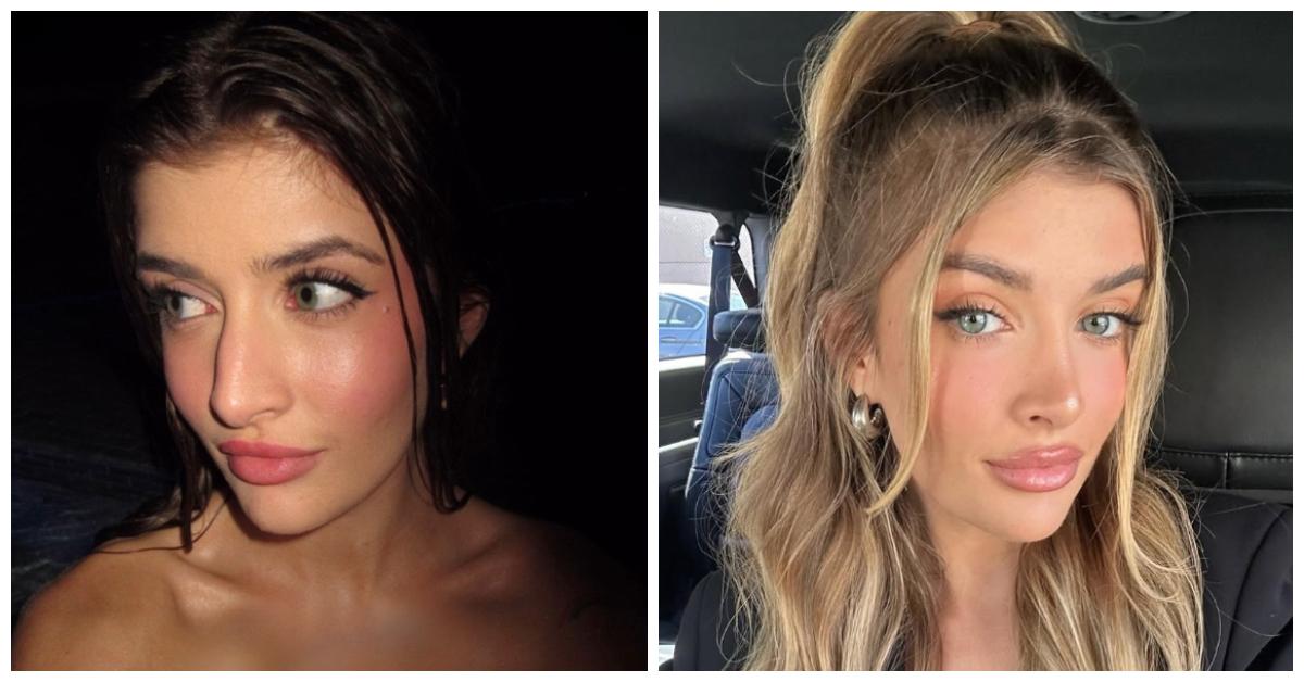 Sami Sheen Reveals Nose Job Results Before and After Pics! Sami Sheen Reveals Nose Job Results Before and After Pics!