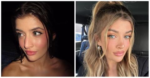 Sami Sheen's nose job transformation, before and after photos!