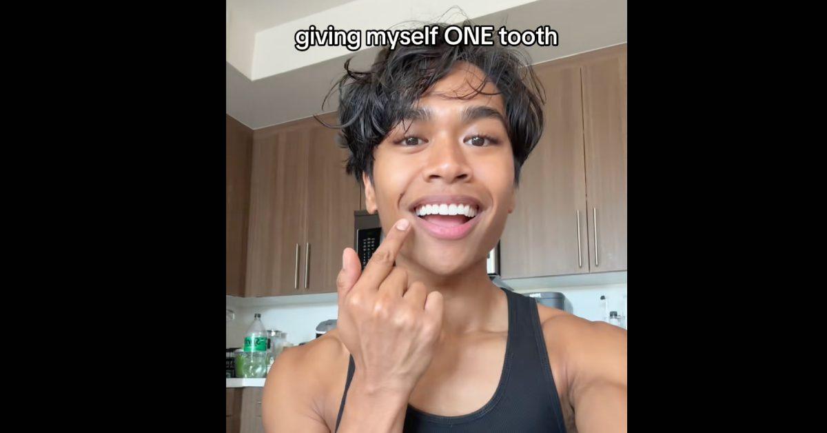 Angelo Marasigan attempting the "giving myself one tooth" TikTok trend.