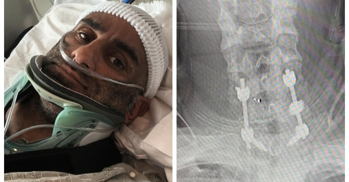 (L-R): Fouad Abiad in the hospital; X-ray of Fouad Abiad's spine