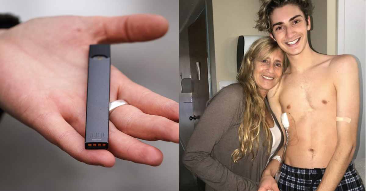 Teenager's Lung Collapses After Vaping for 18 Months