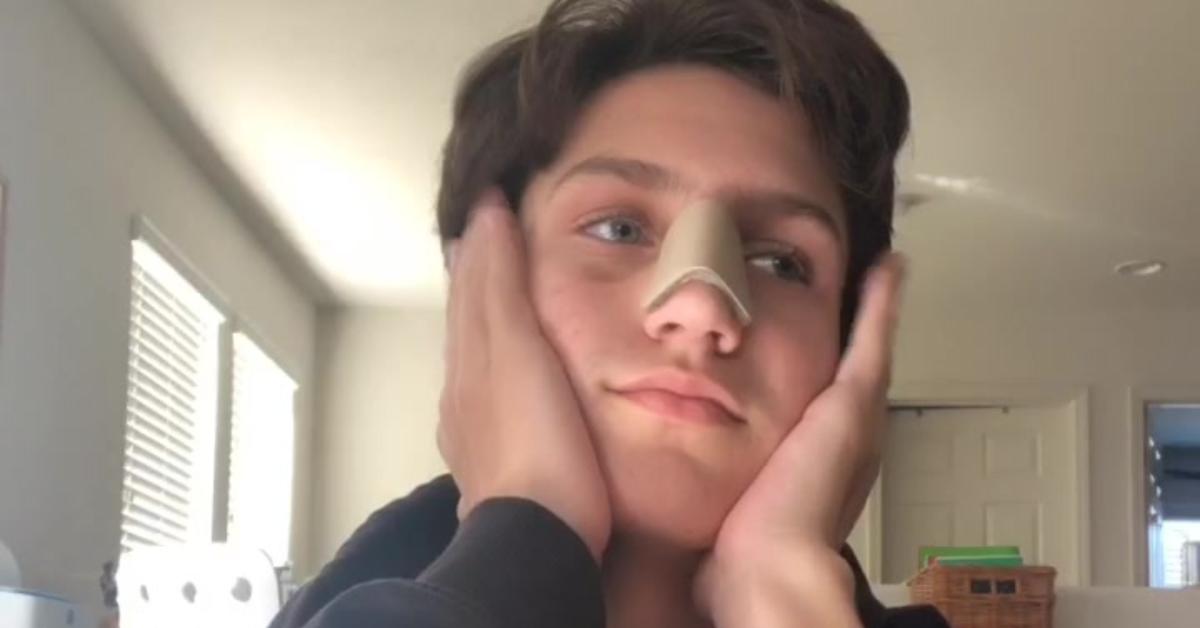 chase hudson broken nose