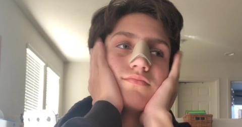 chase hudson broken nose