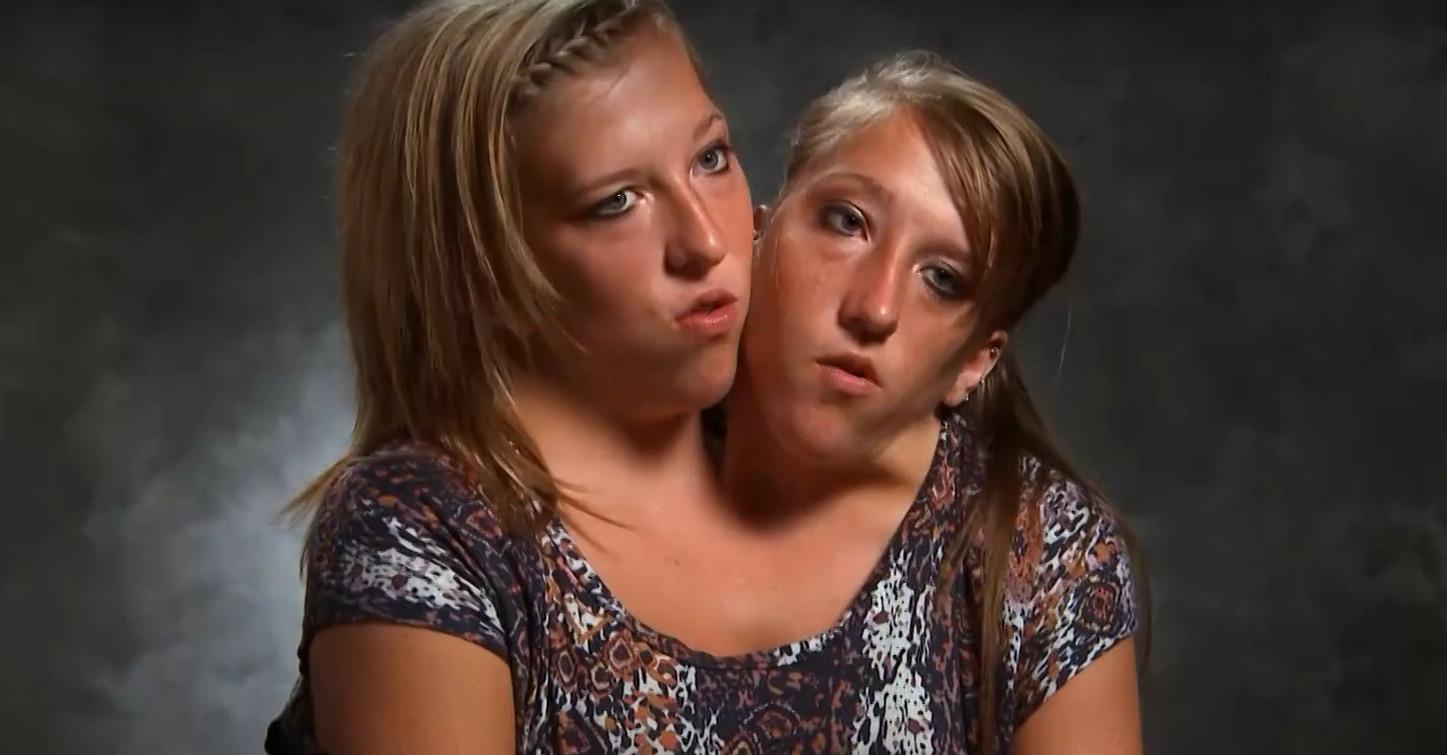 abby-and-brittany-travel-together